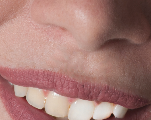 Ch. 10: Retouch and Heal